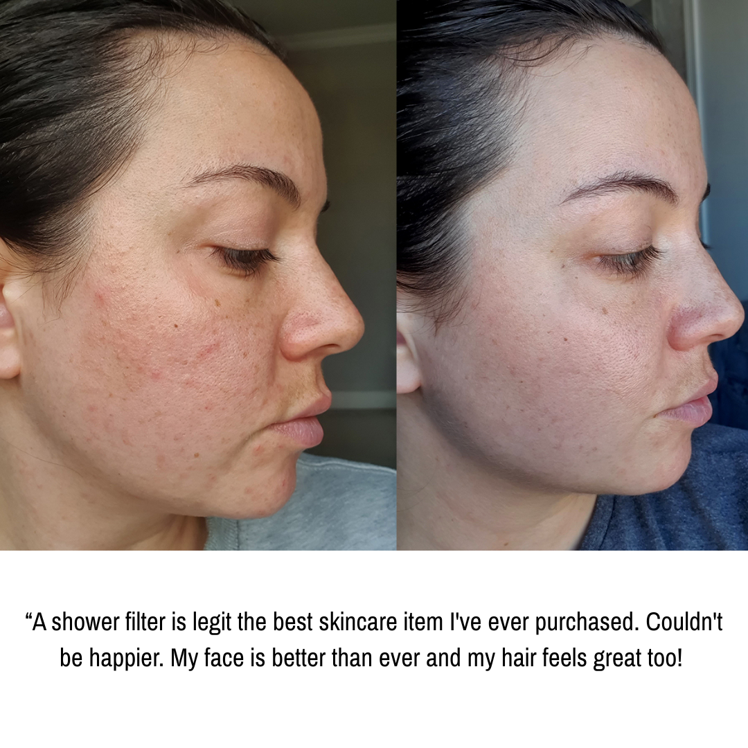 Filtered Shower Head (6 Months Set)